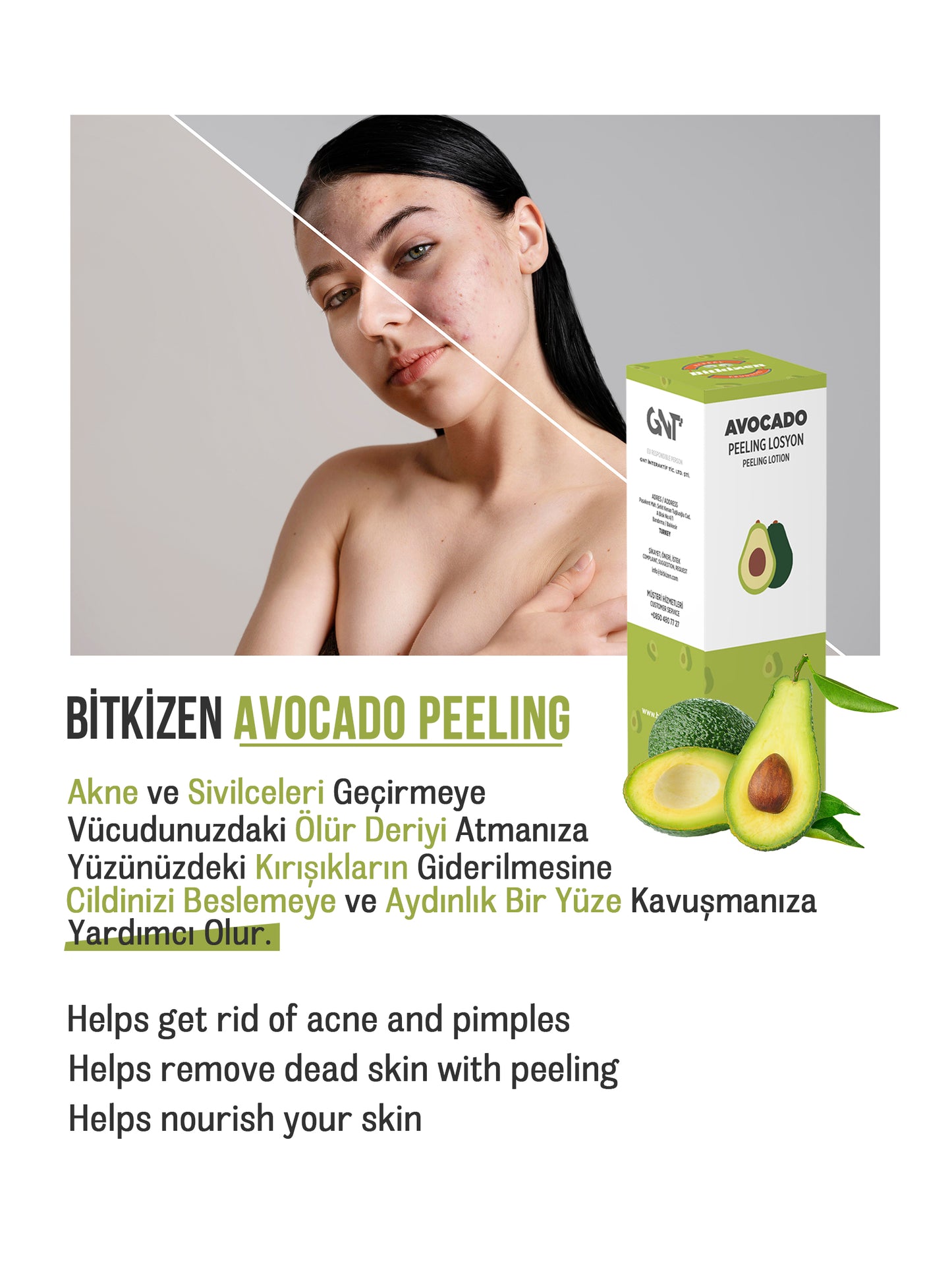 Besleyici, Arındırıcı ve Nemlendirici Peeling